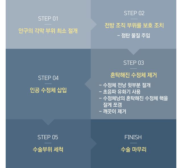 최소 절개 프리미엄 초음파 백내장 수술