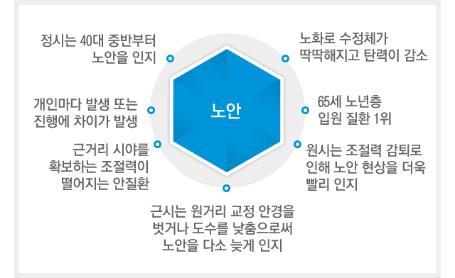 노안이란