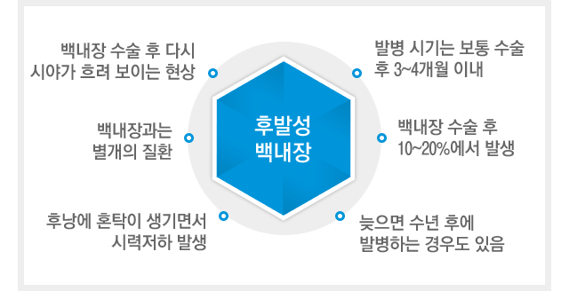 후발성백내장이란