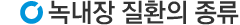 종류