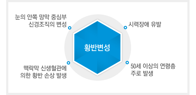 황반변성이란