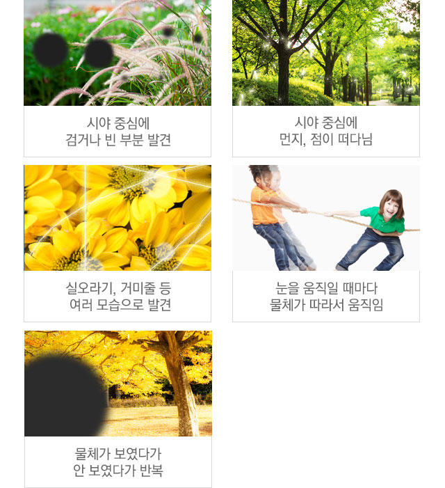 비문증증상