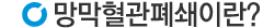 망막혈관폐쇄이란