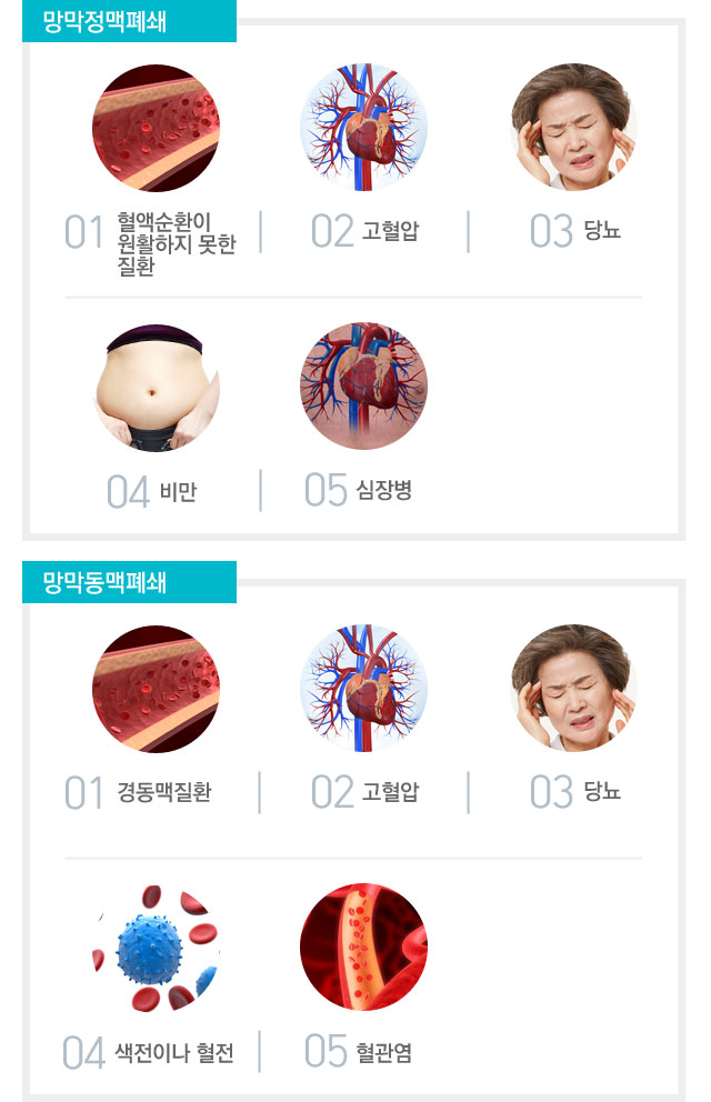 망막혈관폐쇄상원인