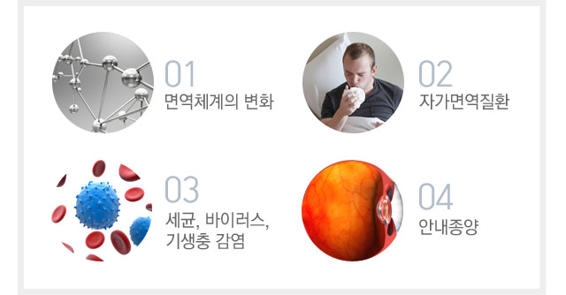 포도막염원인