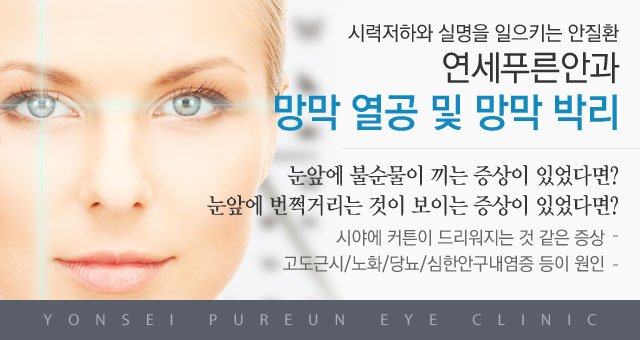 망막 열공 및 망막 박리메인이미지